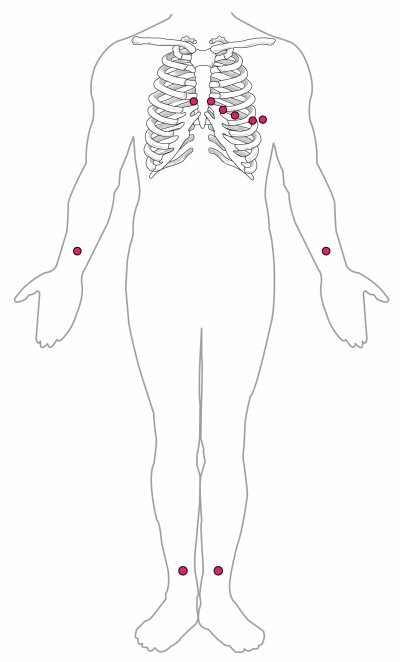 4-2-3. Cardiac Muscle and Electrical Activity posterior ecg lead placement diagram 